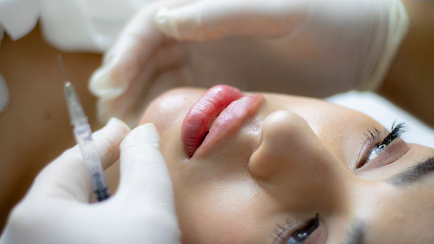Preenchimento facial